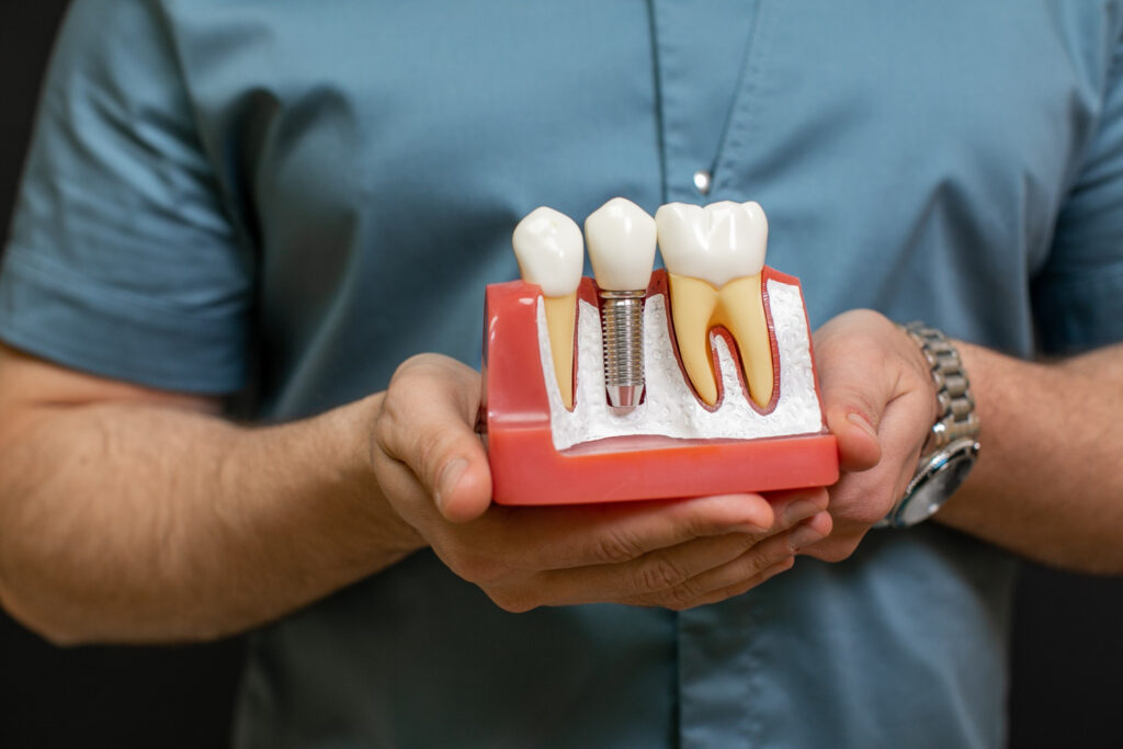 Całkowity koszt implantu zęba – ile realnie zapłacisz za odbudowę uśmiechu?