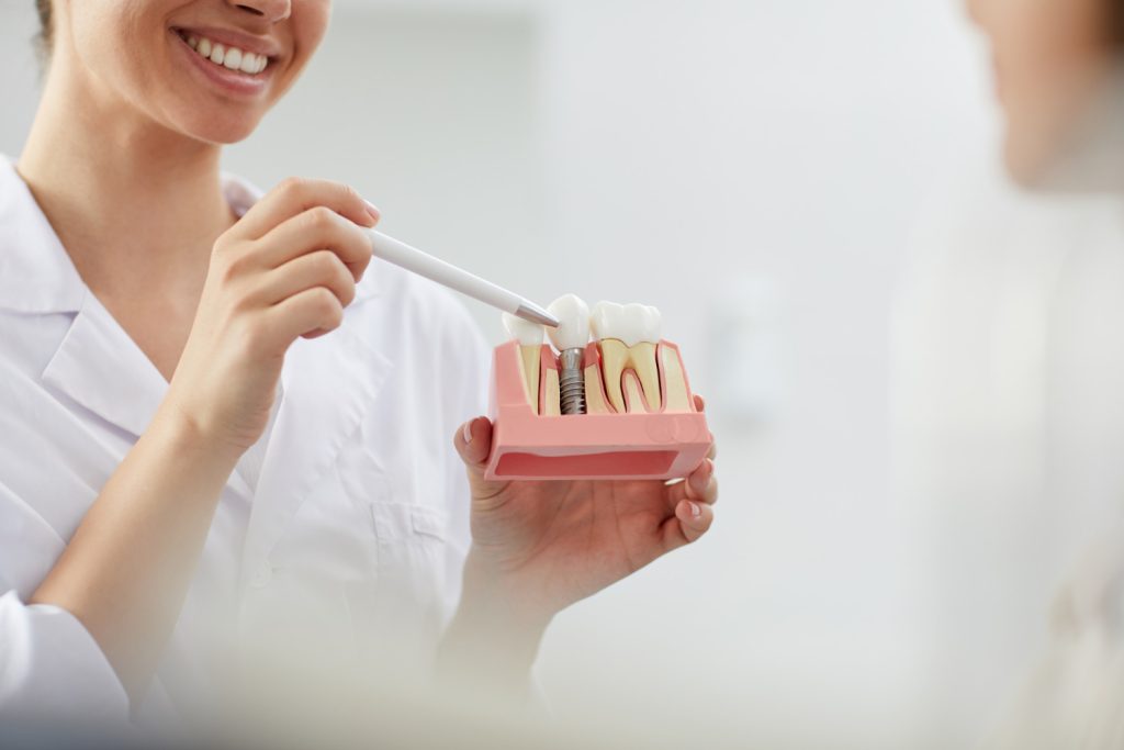 Trwałość implantów zębowych